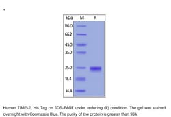 ACROBiosystems ACROBiosystems Human TIMP-2 Protein, His Tag, Quantity: