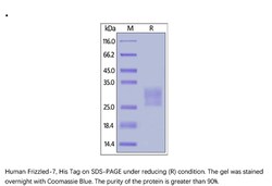 ACROBiosystems ACROBiosystems Human Frizzled-7 / FZD7 Protein, His Tag,