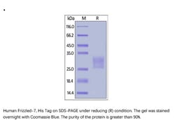 ACROBiosystems ACROBiosystems Human Frizzled-7 / FZD7 Protein, His Tag,