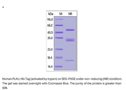 ACROBiosystems ACROBiosystems Human PLAU / uPA Protein, His Tag (activated
