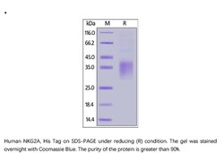 ACROBiosystems ACROBiosystems Human NKG2A / CD159a Protein, His Tag, Quantity: