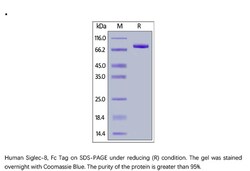 ACROBiosystems ACROBiosystems Human Siglec-8 Protein, Fc Tag, Quantity: