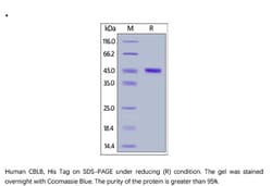 ACROBiosystems ACROBiosystems Human CBLB / RNF56 Protein, His Tag, Quantity: