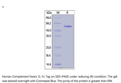ACROBiosystems ACROBiosystems Human Complement Factor D / CFD Protein,