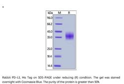 ACROBiosystems ACROBiosystems Rabbit PD-L1 / B7-H1 Protein, His Tag, Quantity: