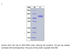 ACROBiosystems ACROBiosystems Human DLL3 Protein, His Tag, Quantity: Each