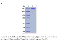 ACROBiosystems ACROBiosystems Human IL-31 RA Protein, Fc Tag, Quantity: