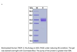 ACROBiosystems ACROBiosystems Biotinylated Human TROP-2 / TACSTD2 Protein,