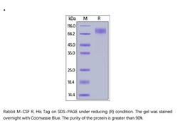 ACROBiosystems ACROBiosystems Rabbit M-CSF R / CSF1R / CD115 Protein, His
