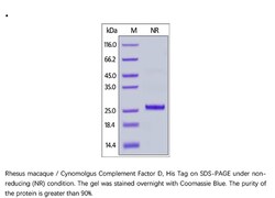 ACROBiosystems ACROBiosystems Rhesus macaque / Cynomolgus Complement Factor