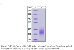ACROBiosystems ACROBiosystems Human PSCA Protein, His Tag, Quantity: Each