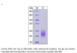 ACROBiosystems ACROBiosystems Human PSCA Protein, His Tag, Quantity: Each