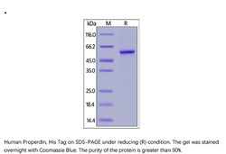 ACROBiosystems Human Properdin Protein, His Tag