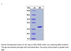 ACROBiosystems ACROBiosystems Human Complement Factor D / CFD Protein,