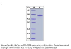 ACROBiosystems ACROBiosystems Human Tau-441 / 2N4R Protein, His Tag, Quantity: