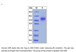 ACROBiosystems ACROBiosystems Human GFR alpha-like Protein, His Tag, Quantity: