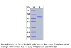 ACROBiosystems ACROBiosystems Human Frizzled-2 / FZD2 Protein, Fc Tag,