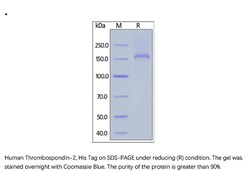 ACROBiosystems ACROBiosystems Human Thrombospondin-2 Protein, His Tag,