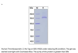 ACROBiosystems ACROBiosystems Human Thrombospondin-2 Protein, His Tag,