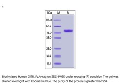 ACROBiosystems ACROBiosystems Biotinylated Human GITR / TNFRSF18 Protein,