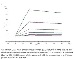 ACROBiosystems ACROBiosystems Human Glypican 3 / GPC3 (S359F) Protein,