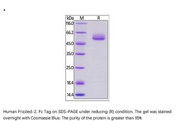 ACROBiosystems ACROBiosystems Human Frizzled-2 / FZD2 (24-190) Protein,