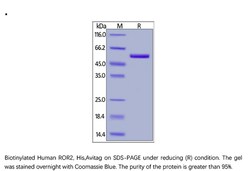 ACROBiosystems ACROBiosystems Biotinylated Human ROR2 / NTRKR2 Protein,