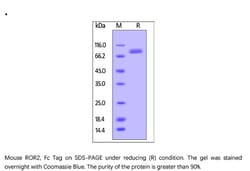 ACROBiosystems ACROBiosystems Mouse ROR2 / NTRKR2 Protein, Fc Tag, Quantity: