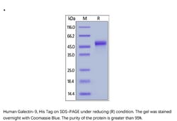ACROBiosystems ACROBiosystems Human Galectin-9 / LGALS9 Protein, His Tag,
