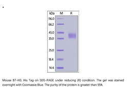 ACROBiosystems ACROBiosystems Mouse B7-H3 / CD276 Protein, His Tag, Quantity: