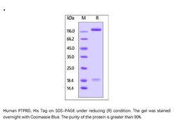 ACROBiosystems ACROBiosystems Human PTPRD Protein, His Tag, Quantity: Each