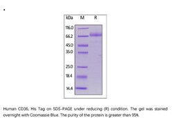 ACROBiosystems ACROBiosystems Human CD36 / SR-B3 Protein, His Tag, Quantity: