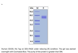 ACROBiosystems ACROBiosystems Human CD155 / PVR Protein, His Tag, Quantity:
