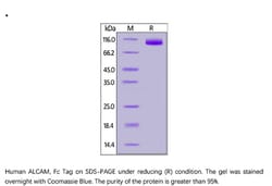 ACROBiosystems ACROBiosystems Human ALCAM Protein, Fc Tag, Quantity: Each