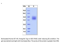 ACROBiosystems ACROBiosystems Biotinylated Human B7-H5 / Gi24 / VISTA Protein,