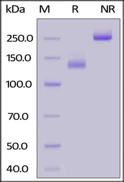 ACROBiosystems ACROBiosystems Human ACE2 / ACEH Protein, Fc Tag (MALS verified),