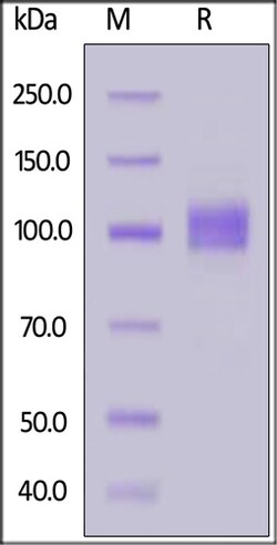 ACROBiosystems ACROBiosystems Biotinylated Human ACE2 / ACEH Protein, His,Avitag