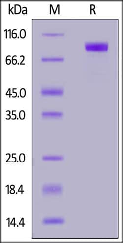 ACROBiosystems ACROBiosystems Biotinylated Human ACE2 / ACEH Protein, His,Avitag