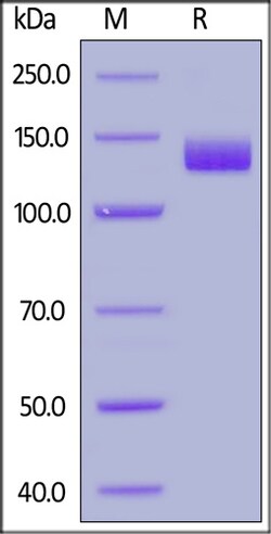ACROBiosystems 25UG BIOTINYLATED HUMAN ACE2, Quantity: Each of 1