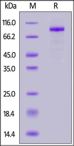 ACROBiosystems ACROBiosystems Mink ACE2 / ACEH Protein, His Tag (MALS verified),