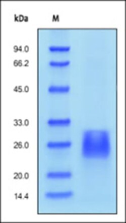 ACROBiosystems ACROBiosystems Human Activin RIIB / ACVR2B Protein, His