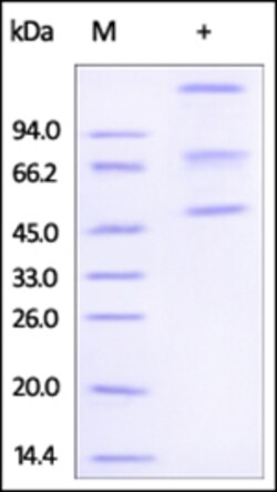 ACROBiosystems ACROBiosystems Human ADAM8 / CD156a Protein, His Tag, Quantity: