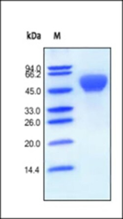 ACROBiosystems ACROBiosystems Human BMPR-IA / ALK-3 Protein, Fc Tag, Quantity: