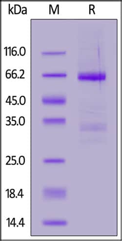 ACROBiosystems ACROBiosystems Human Angiopoietin-like 3 / ANGPTL3 Protein,