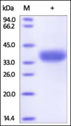 ACROBiosystems Human Angiopoietin-like 4 / ANGPTL4 (166-406) Protein, His