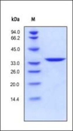ACROBiosystems ACROBiosystems Human Annexin A5 Protein, His Tag, Quantity: