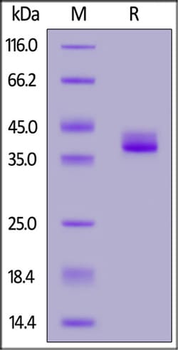ACROBiosystems ACROBiosystems Human Apolipoprotein E / APOE Protein (R154S,R176C),