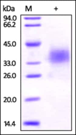 ACROBiosystems ACROBiosystems Human B7-H5 / Gi24 / VISTA Protein, His Tag