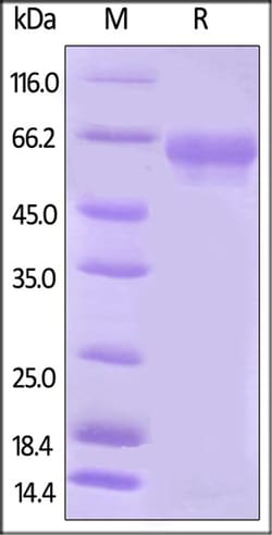 ACROBiosystems ACROBiosystems Biotinylated Human B7-H5 / Gi24 / VISTA Protein,