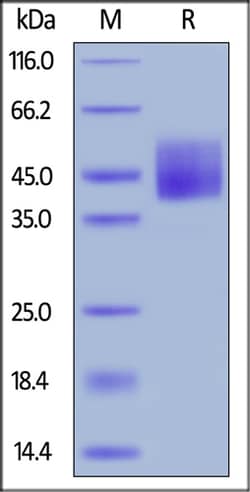 ACROBiosystems ACROBiosystems Human B7-H6 / NCR3LG1 Protein, His Tag, Quantity: